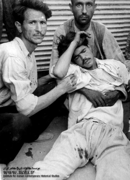 یکی از مجروحین درگیری‌های روز ۳۰ تیر در حوالی میدان بهارستان 